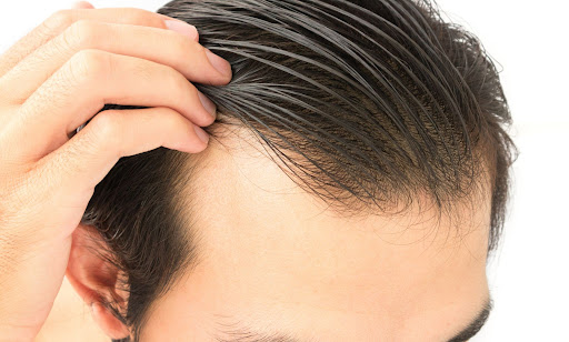 How to Choose the Best Hair Oil For Men?