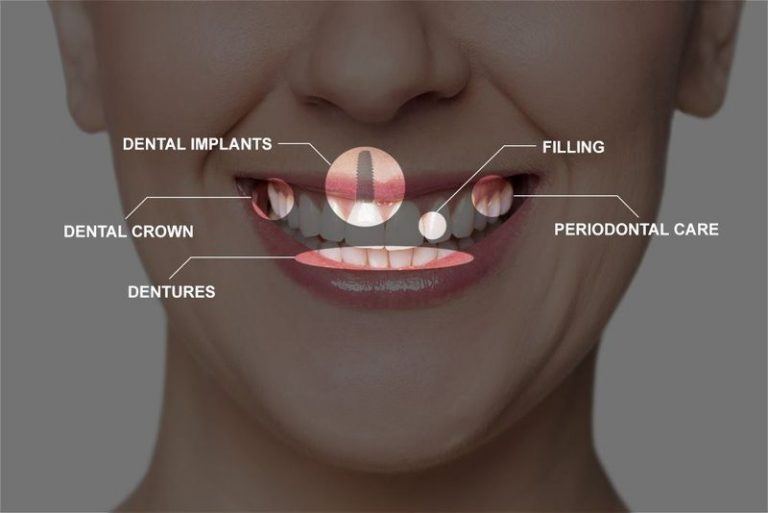 The Whole Mouth Restoration: A Comprehensive Dentistry Solution