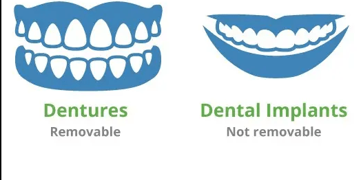 dentures and implants